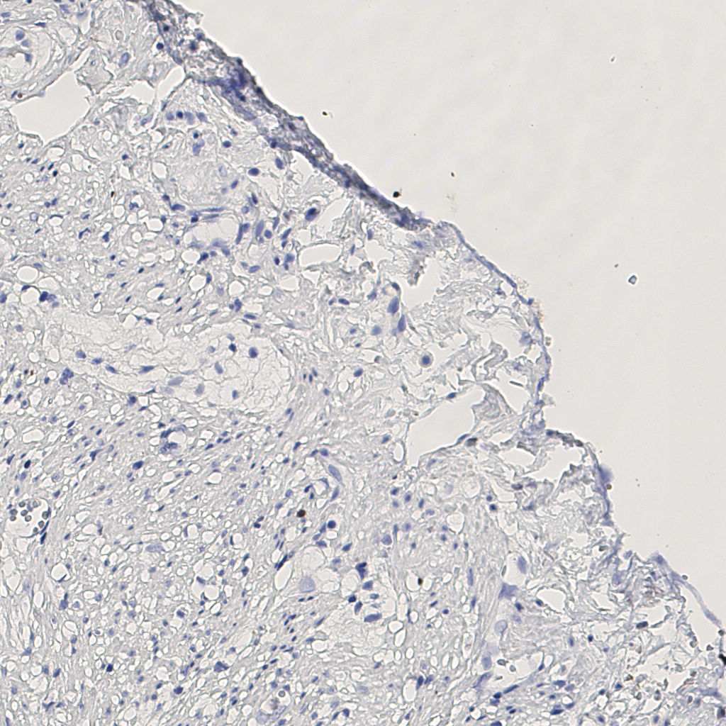 slice_13_20_x11648_y17920.png