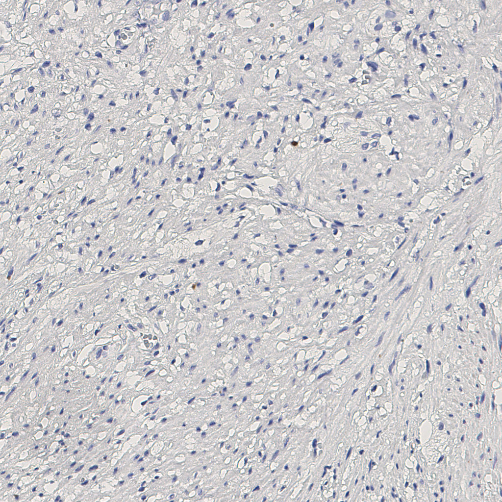 slice_13_25_x11648_y22400.png