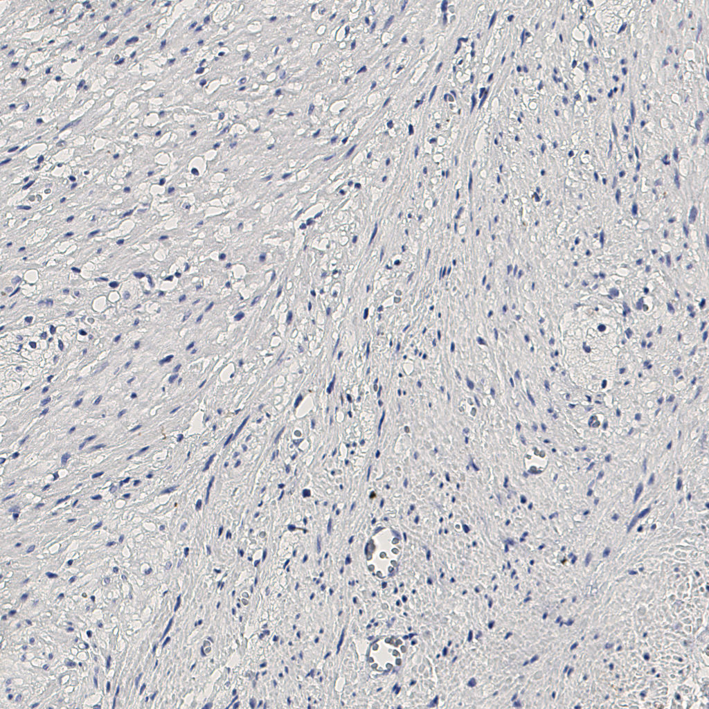 slice_13_26_x11648_y23296.png