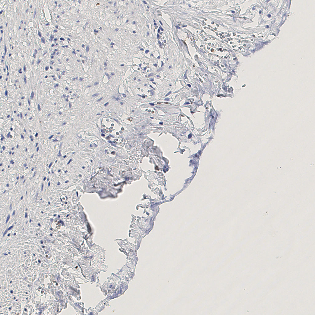 slice_14_26_x12544_y23296.png