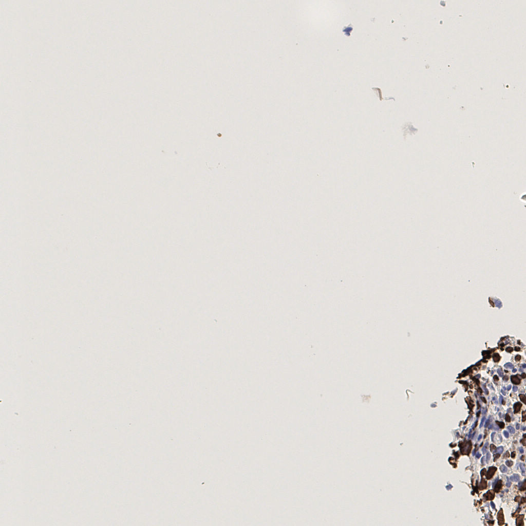 slice_38_6_x34048_y5376.png