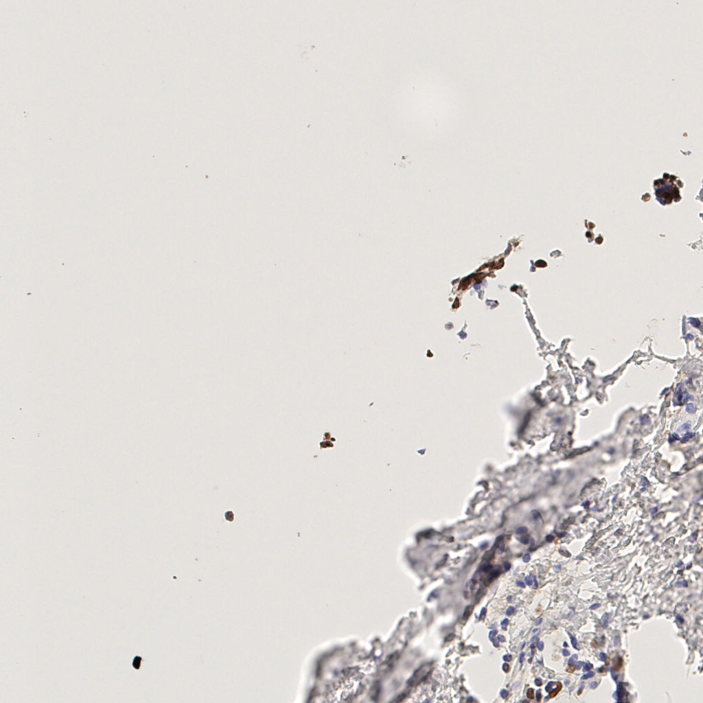 slice_40_13_x35840_y11648.png