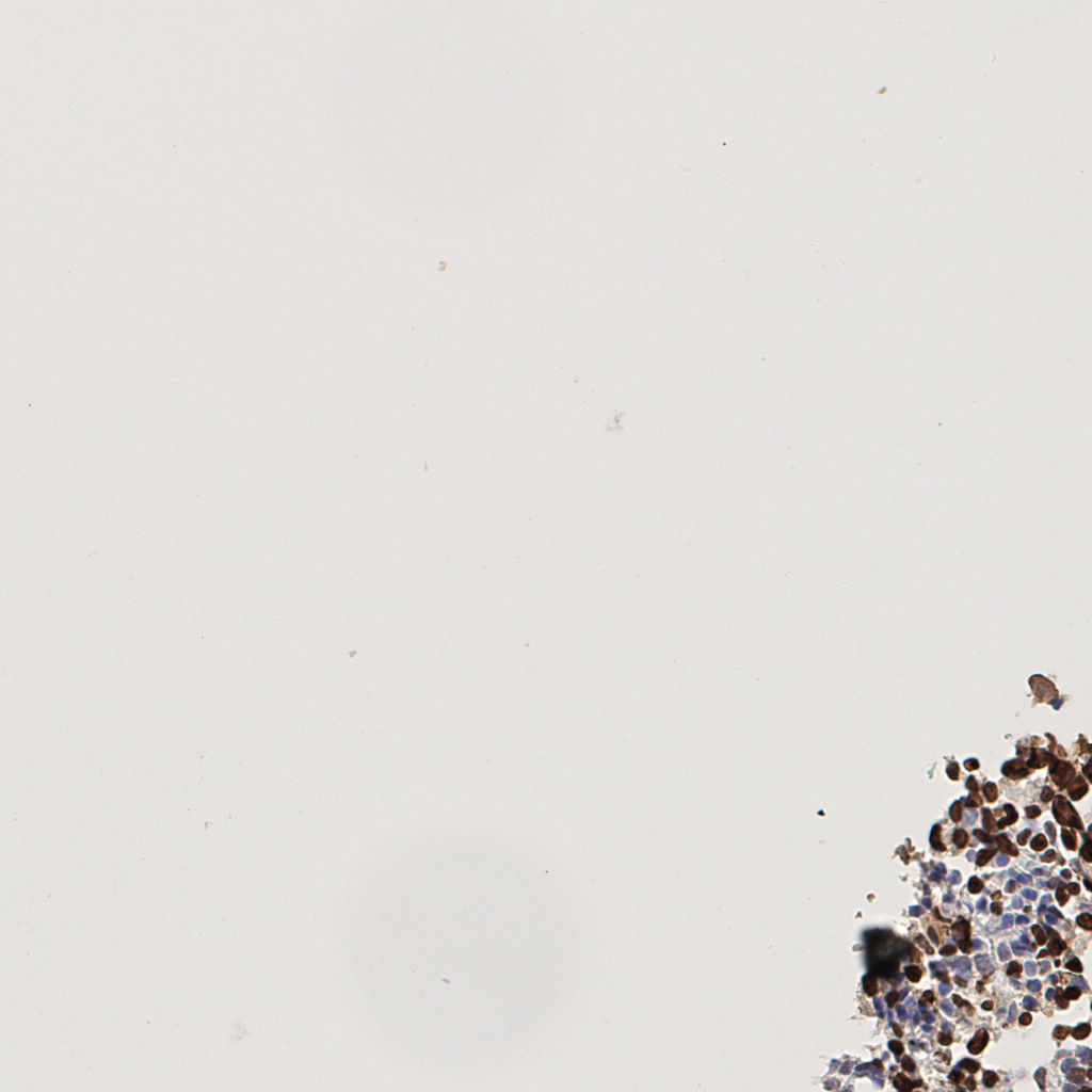 slice_43_2_x38528_y1792.png
