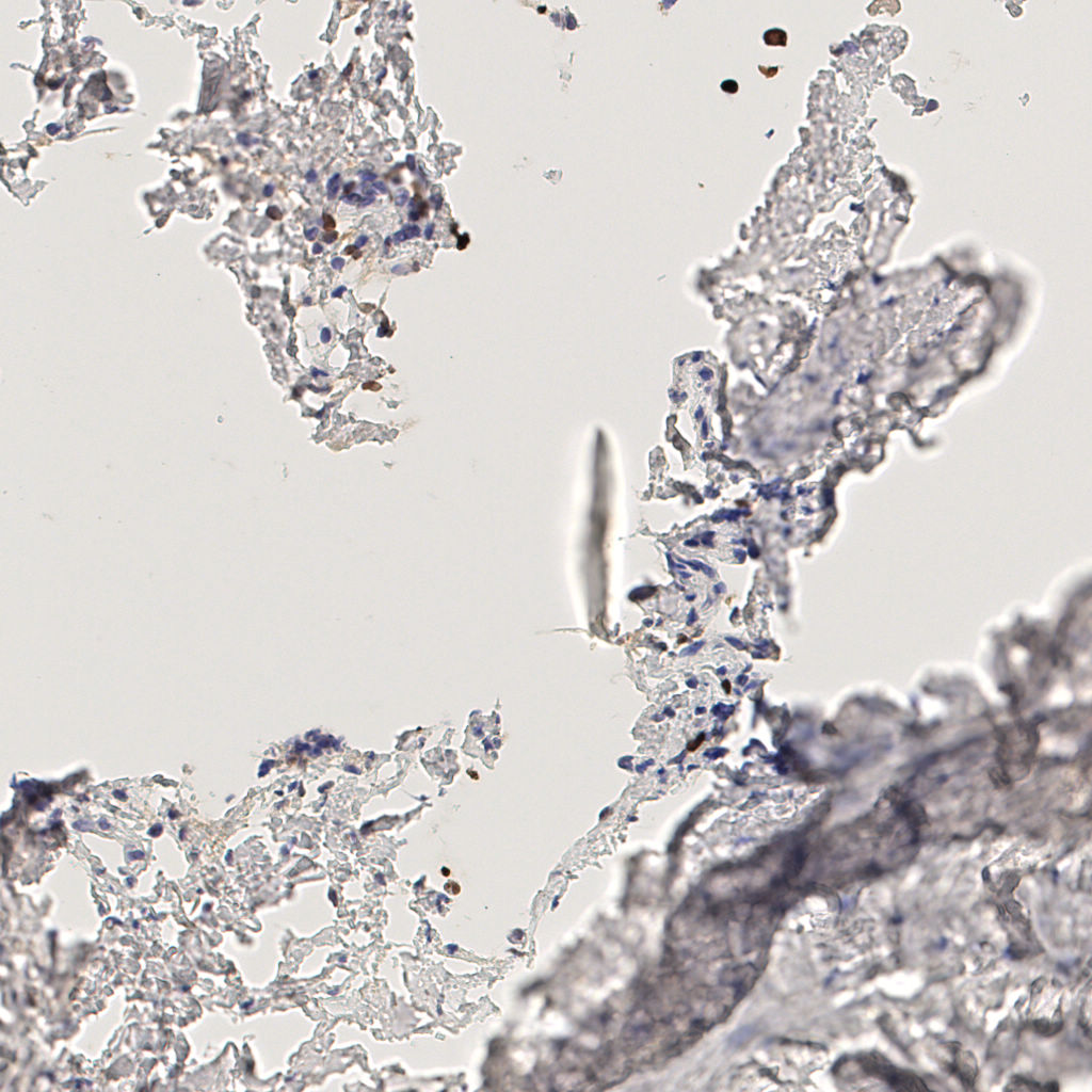 slice_44_12_x39424_y10752.png