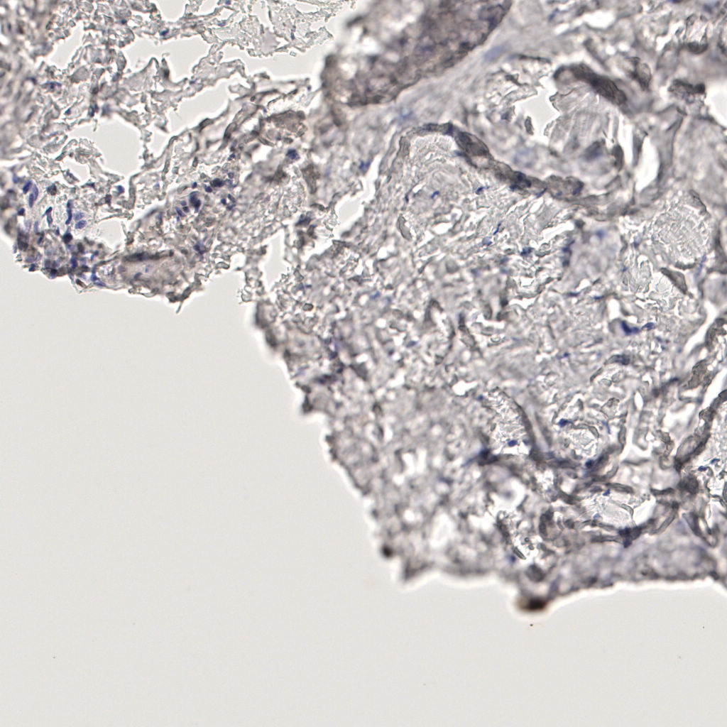 slice_44_13_x39424_y11648.png