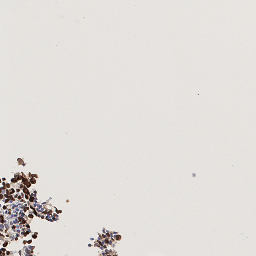 slice_44_2_x39424_y1792.png