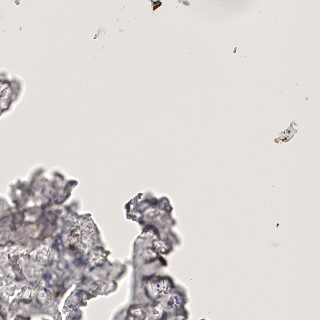 slice_45_12_x40320_y10752.png