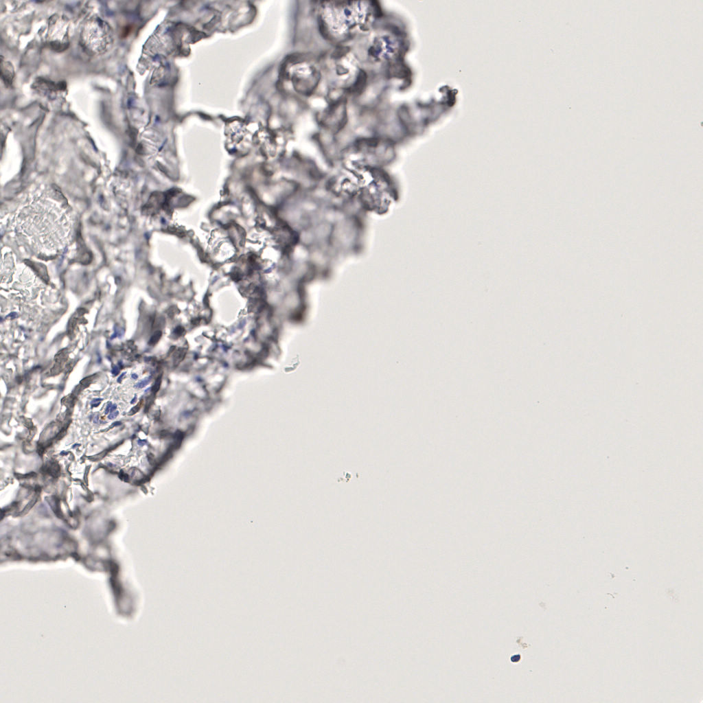 slice_45_13_x40320_y11648.png