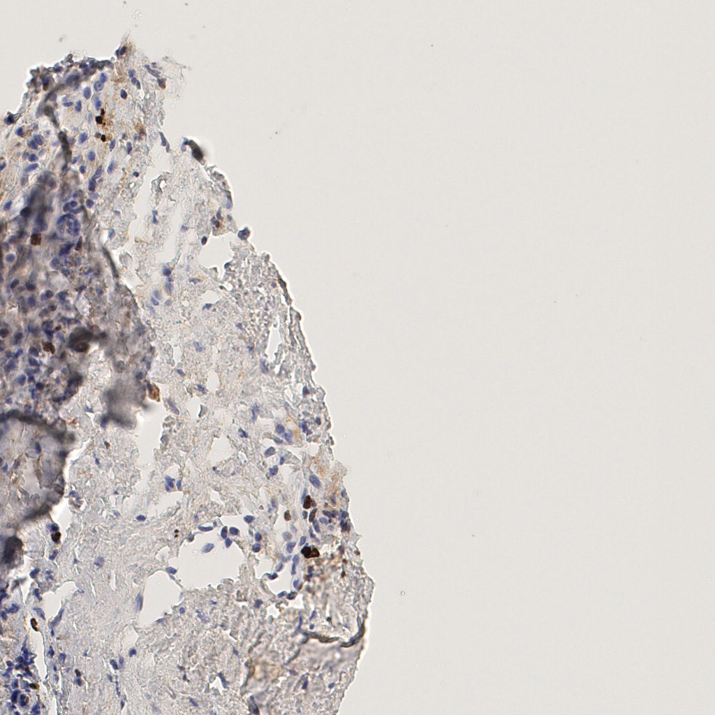 slice_45_17_x40320_y15232.png