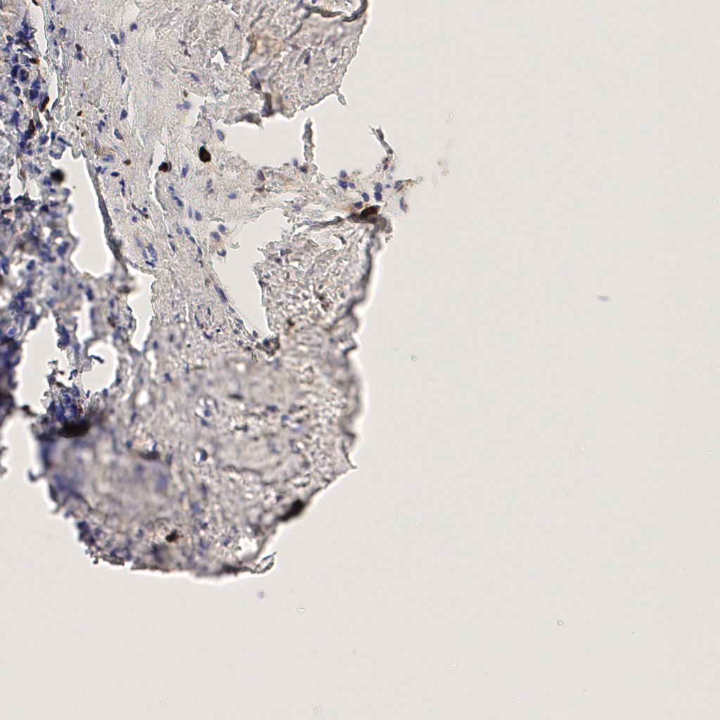 slice_45_18_x40320_y16128.png