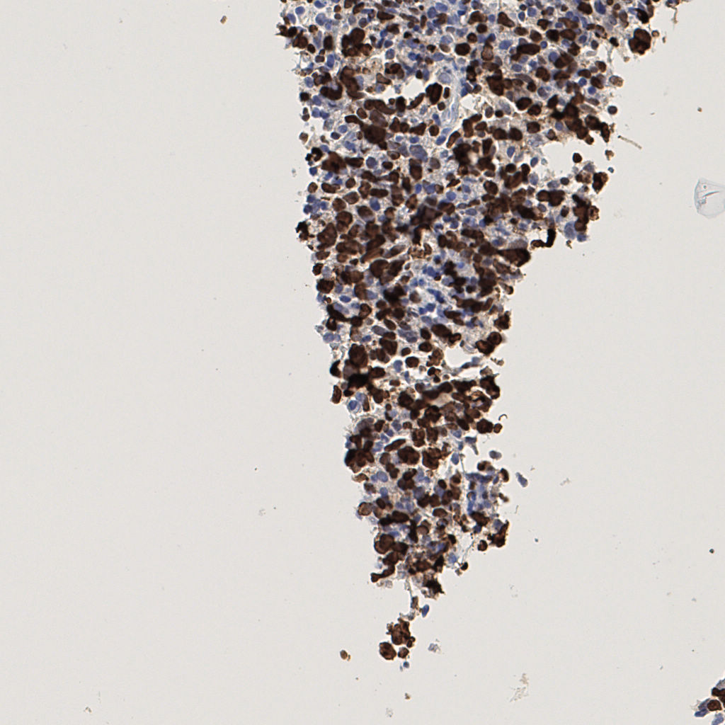 slice_45_7_x40320_y6272.png