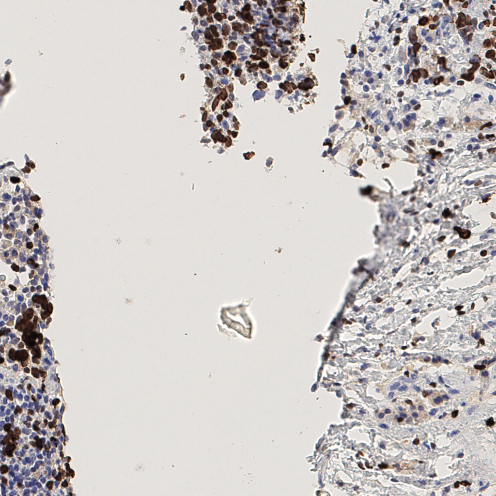 slice_45_9_x40320_y8064.png
