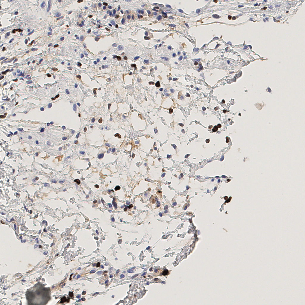 slice_46_10_x41216_y8960.png