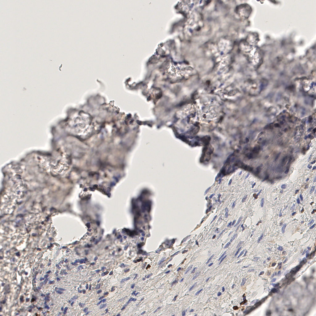 slice_48_12_x43008_y10752.png