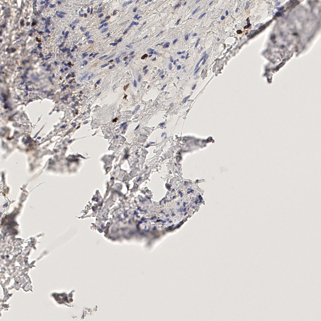 slice_48_13_x43008_y11648.png