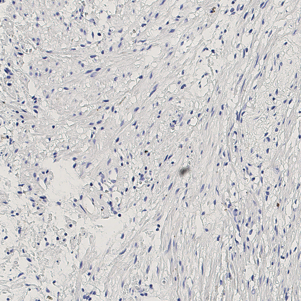 slice_4_23_x3584_y20608.png