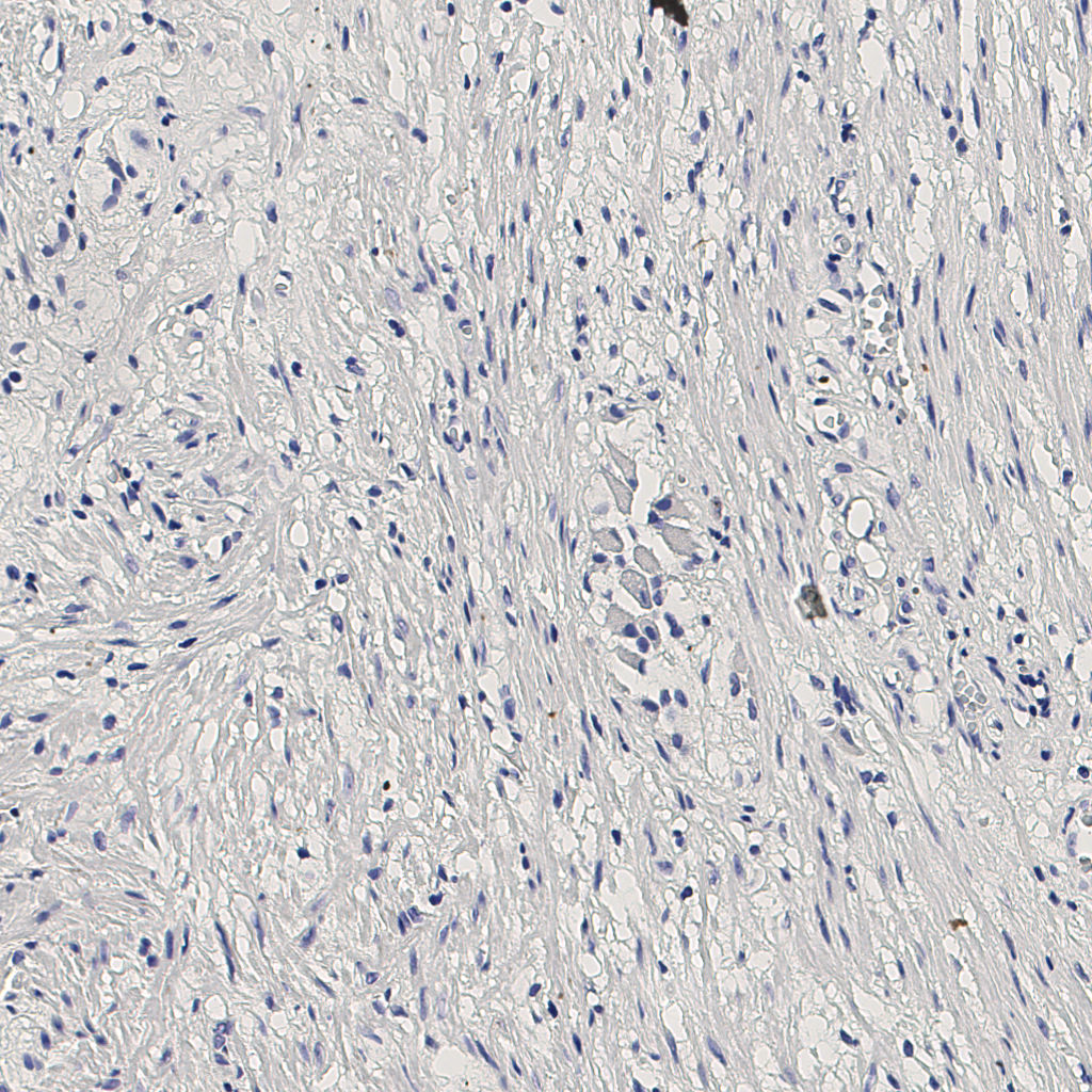 slice_4_25_x3584_y22400.png