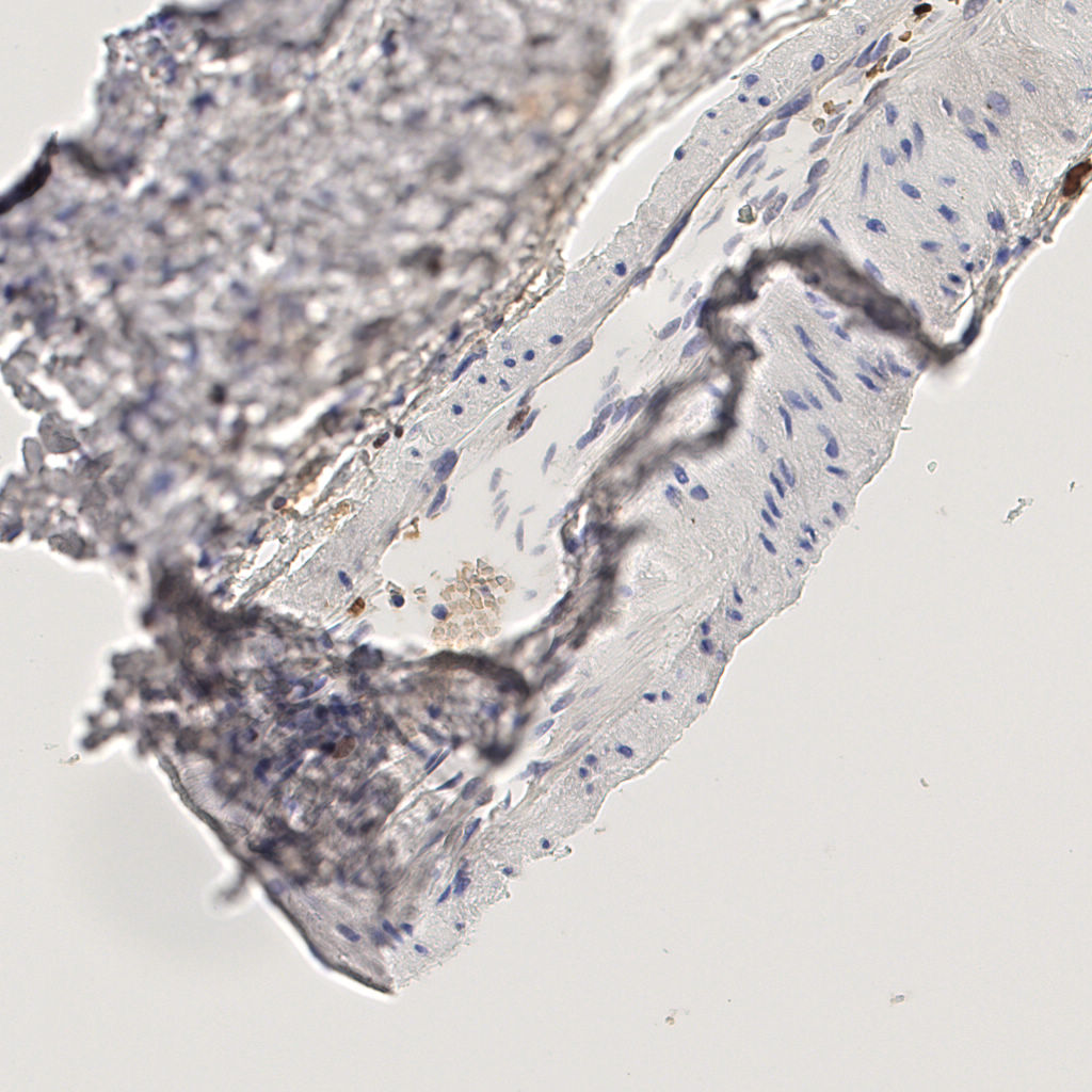 slice_50_10_x44800_y8960.png