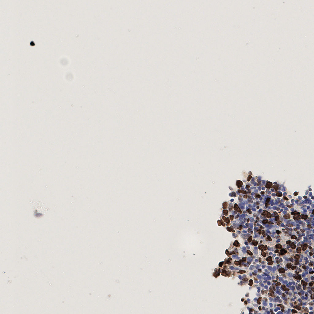 slice_50_18_x44800_y16128.png