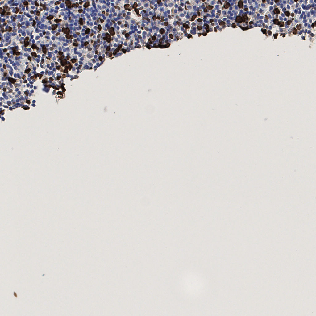 slice_50_5_x44800_y4480.png