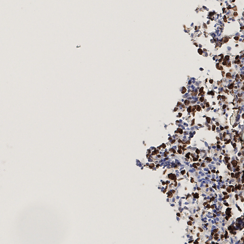 slice_51_16_x45696_y14336.png
