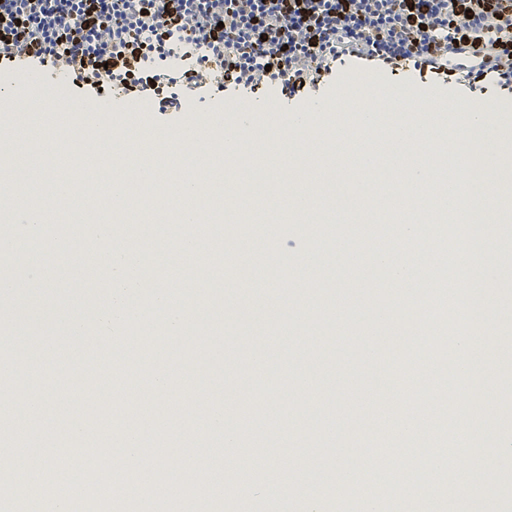 slice_51_5_x45696_y4480.png