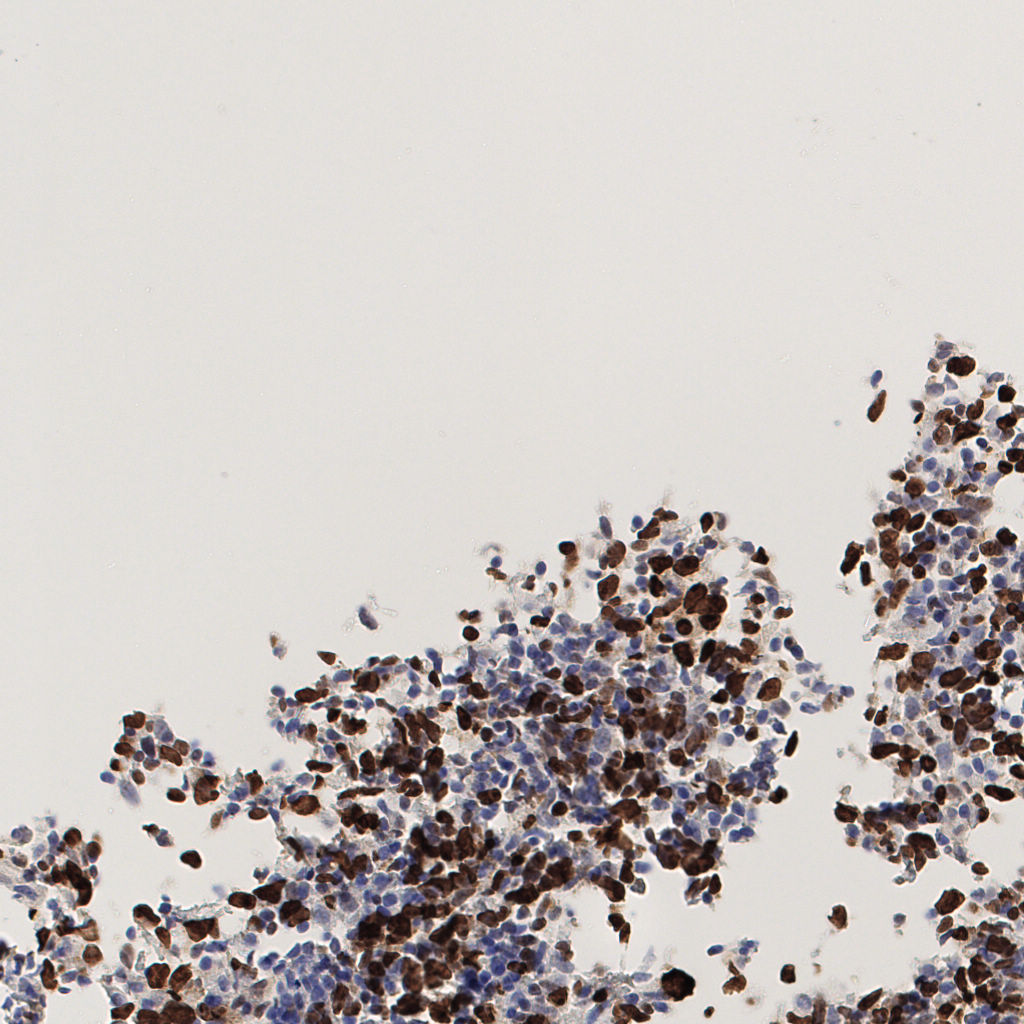 slice_52_15_x46592_y13440.png