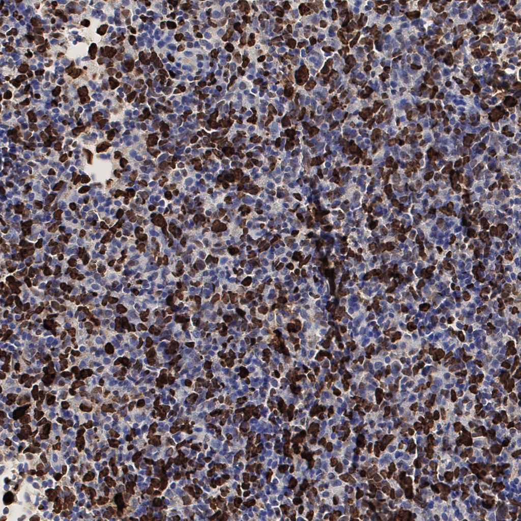 slice_52_19_x46592_y17024.png