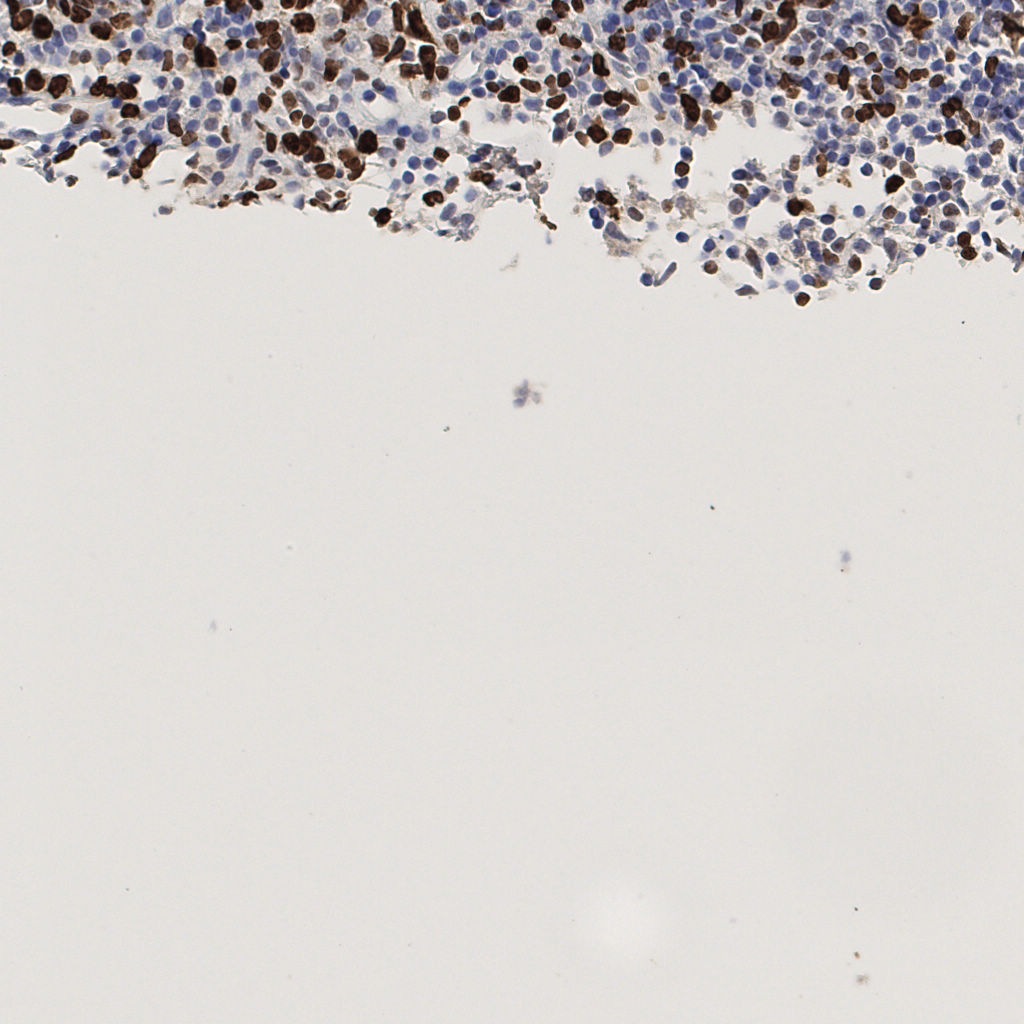 slice_52_5_x46592_y4480.png