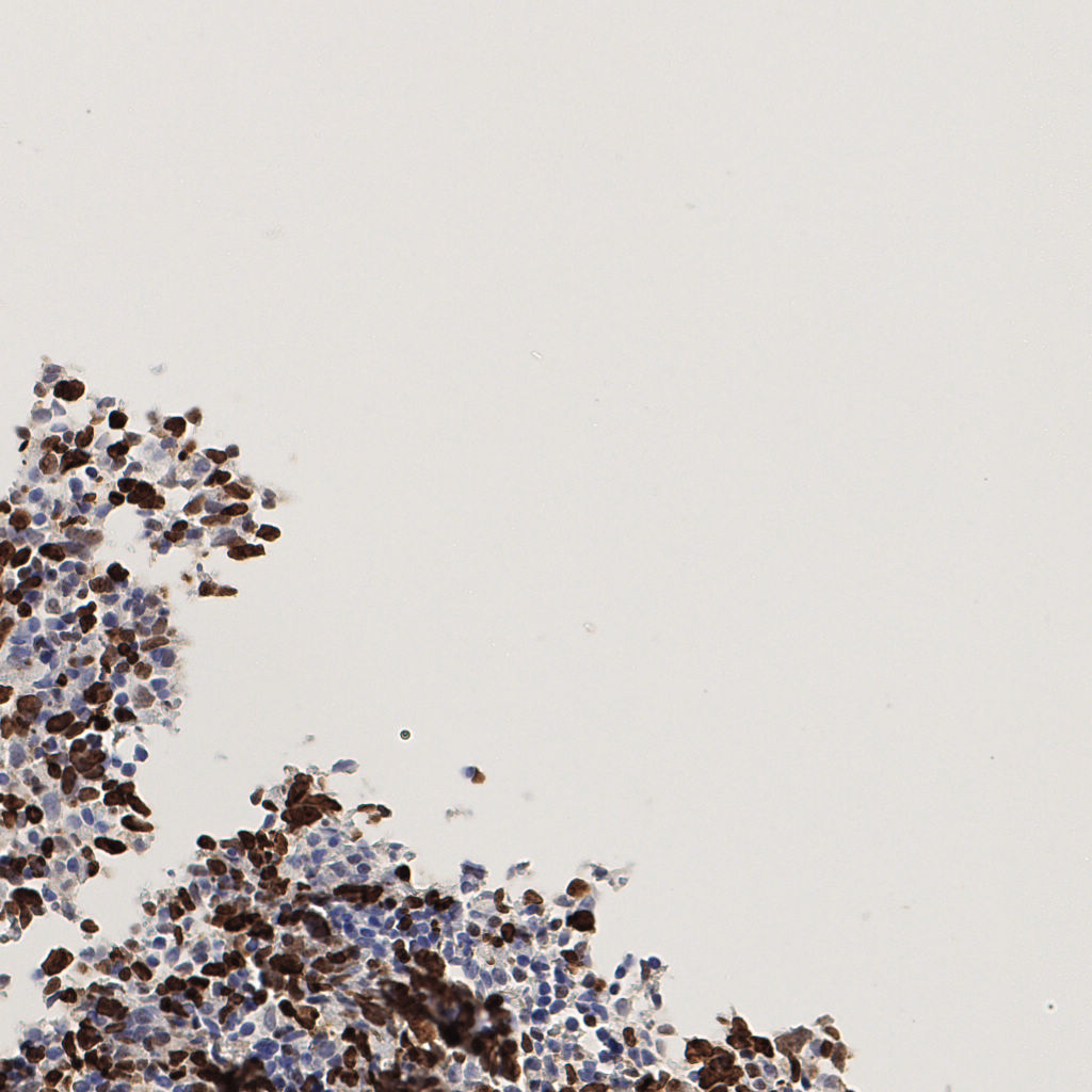 slice_53_15_x47488_y13440.png