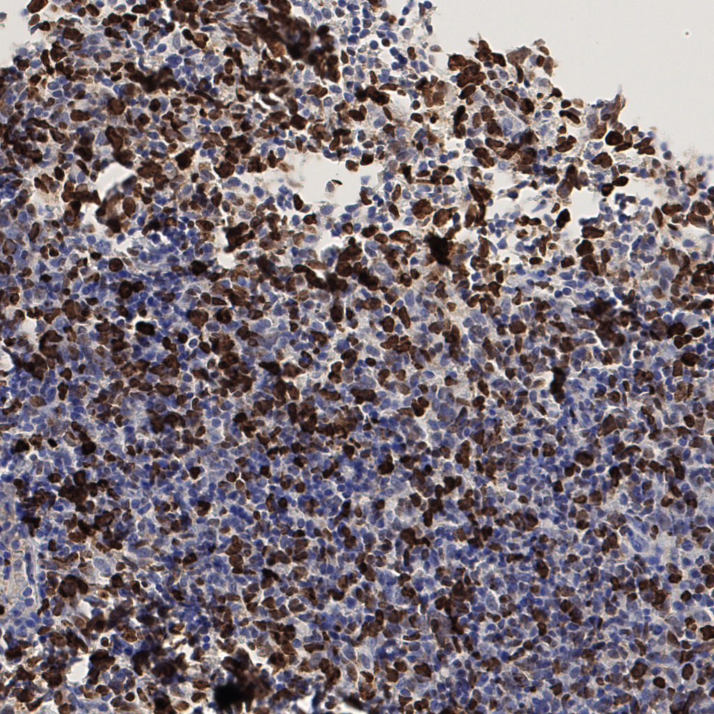 slice_53_16_x47488_y14336.png