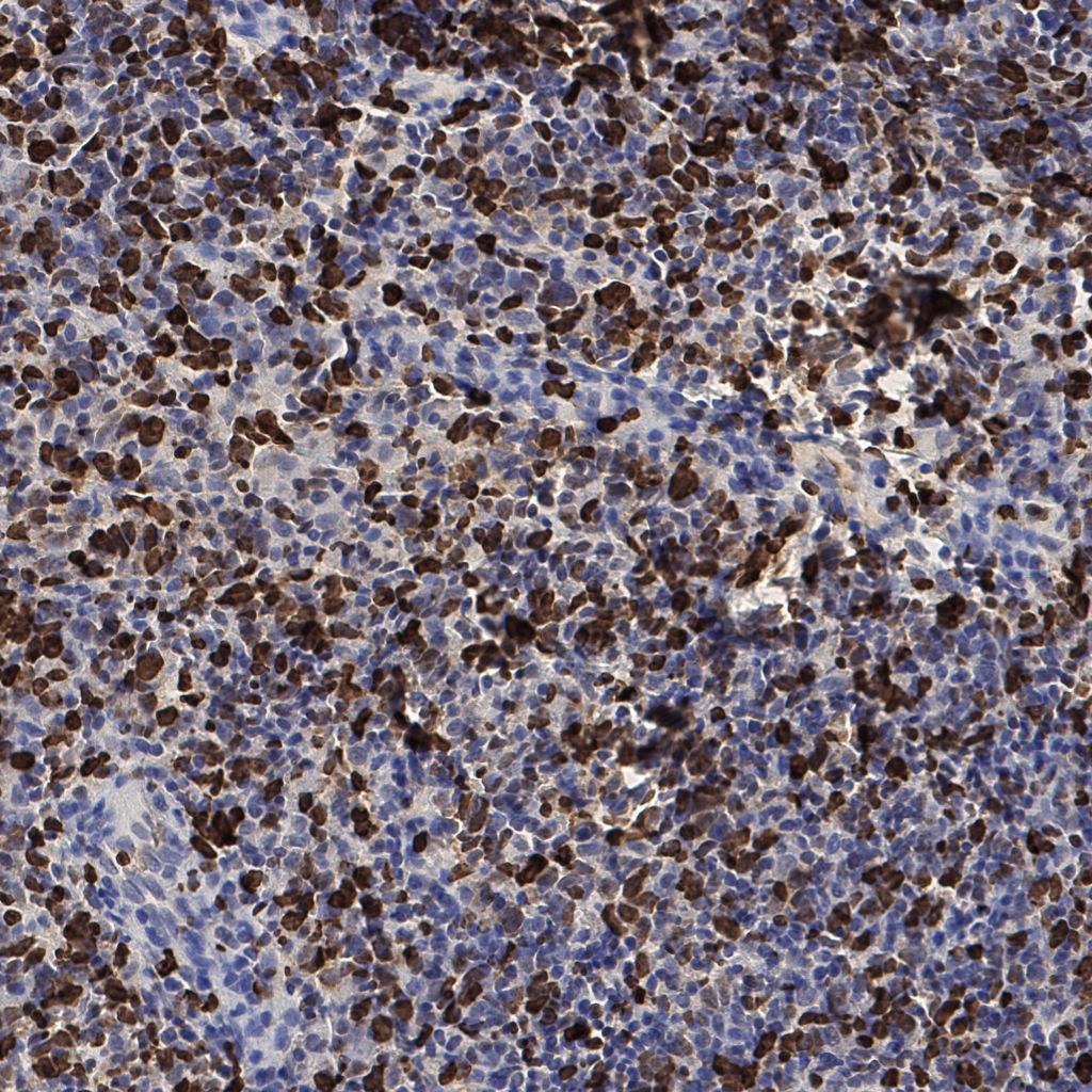 slice_53_18_x47488_y16128.png