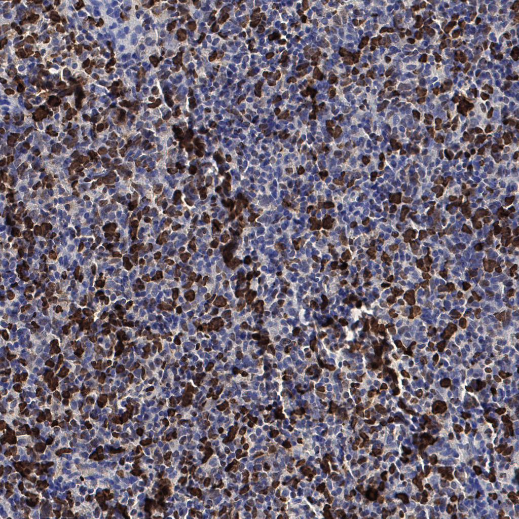 slice_53_19_x47488_y17024.png