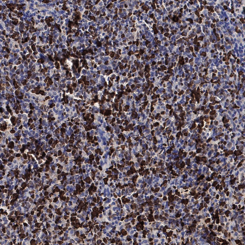 slice_53_20_x47488_y17920.png