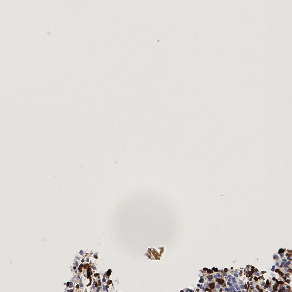 slice_53_2_x47488_y1792.png