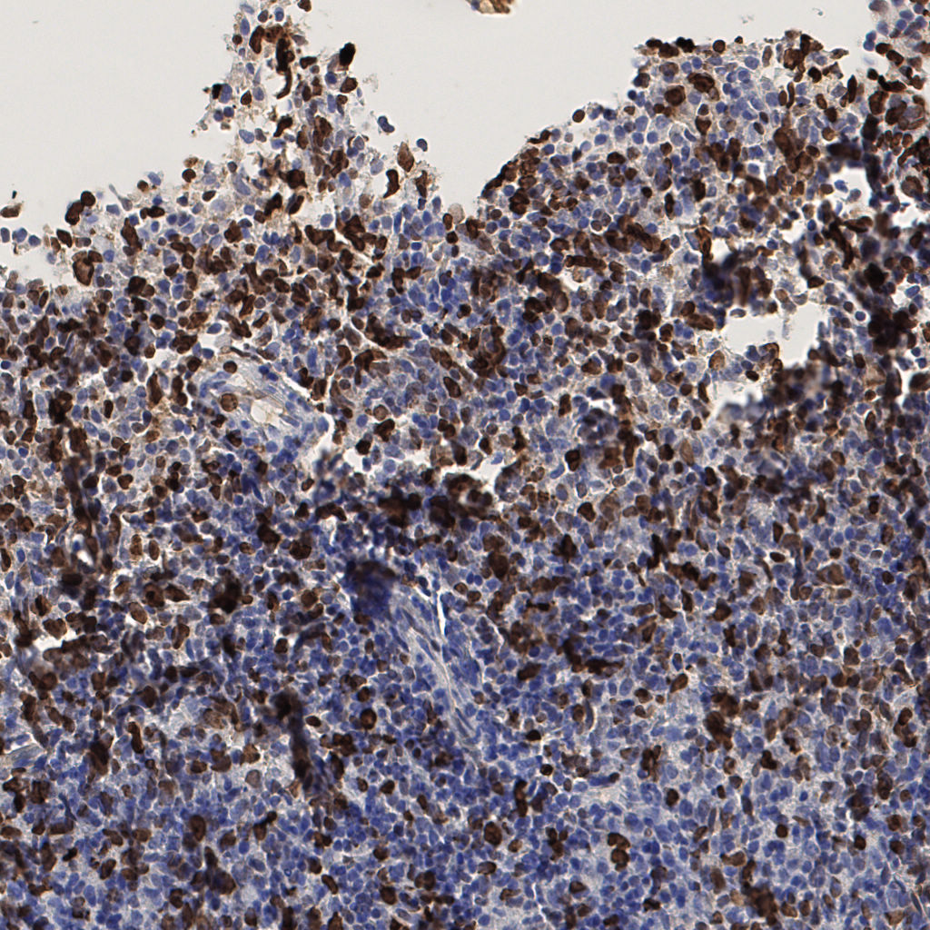 slice_53_3_x47488_y2688.png