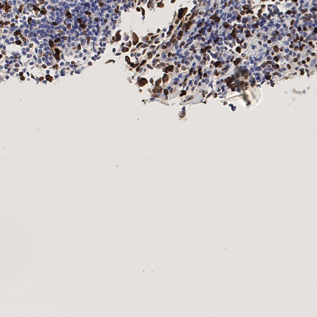 slice_53_5_x47488_y4480.png