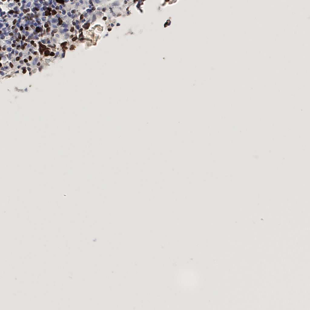 slice_54_5_x48384_y4480.png