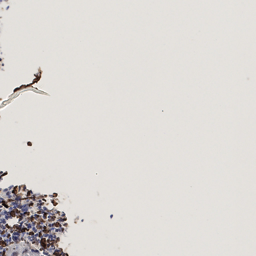 slice_55_17_x49280_y15232.png