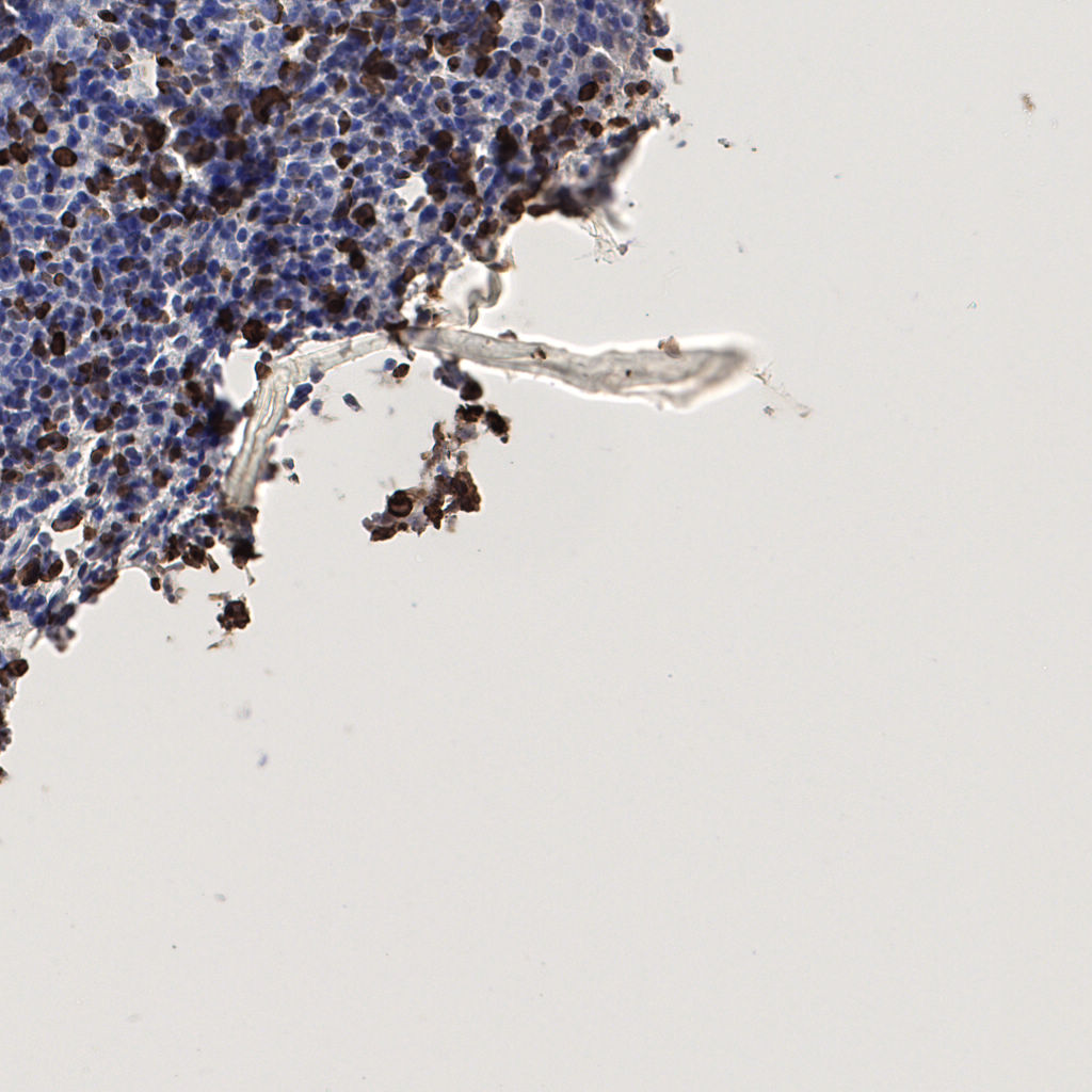 slice_55_4_x49280_y3584.png