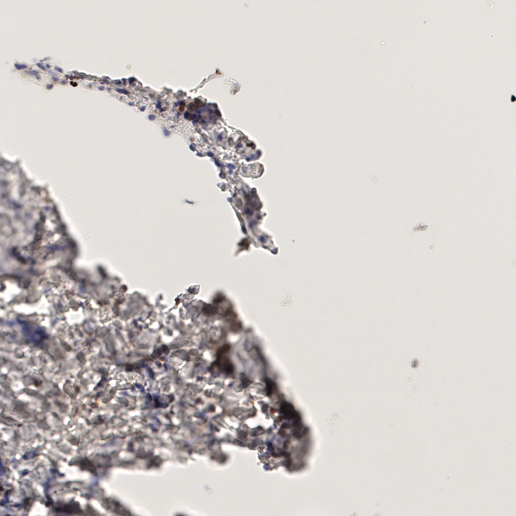 slice_56_2_x50176_y1792.png