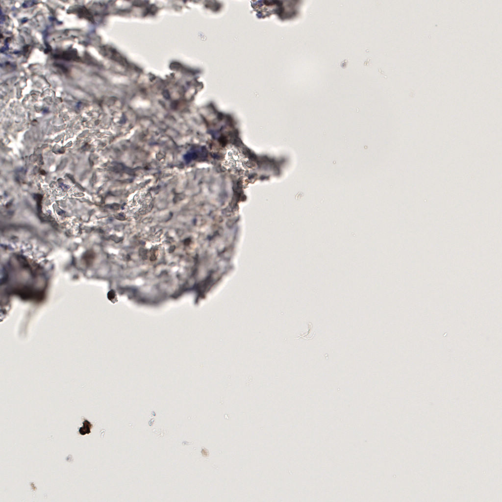 slice_56_3_x50176_y2688.png
