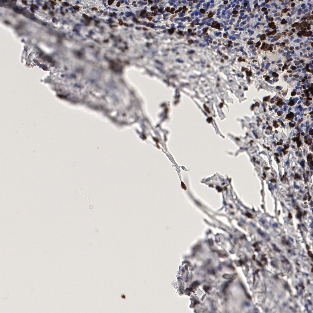 slice_57_10_x51072_y8960.png