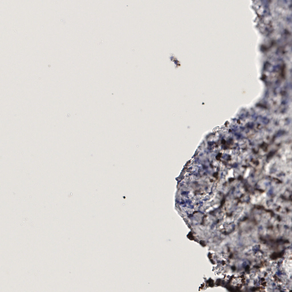 slice_57_12_x51072_y10752.png