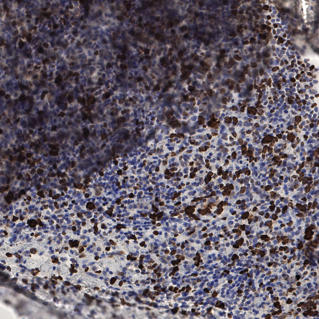 slice_57_9_x51072_y8064.png