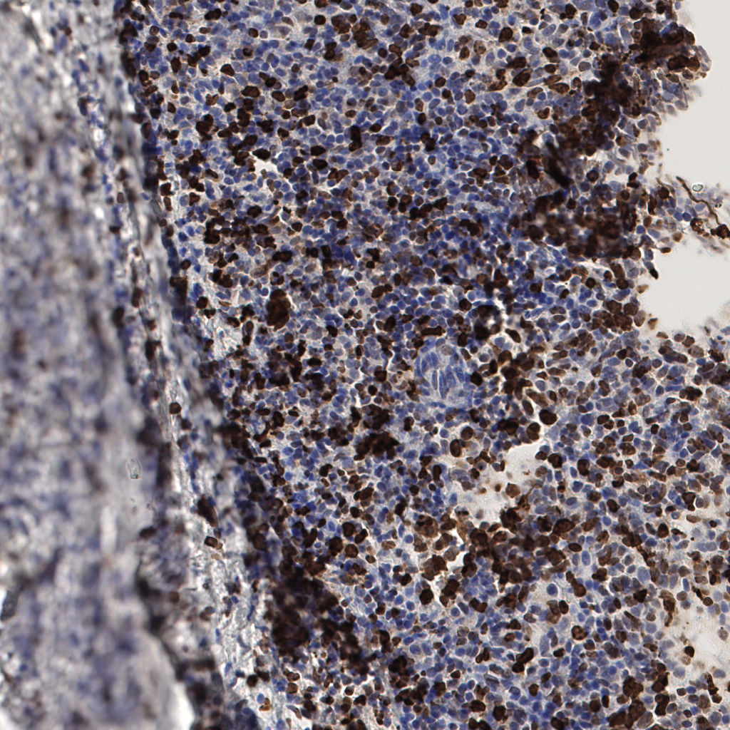 slice_58_11_x51968_y9856.png