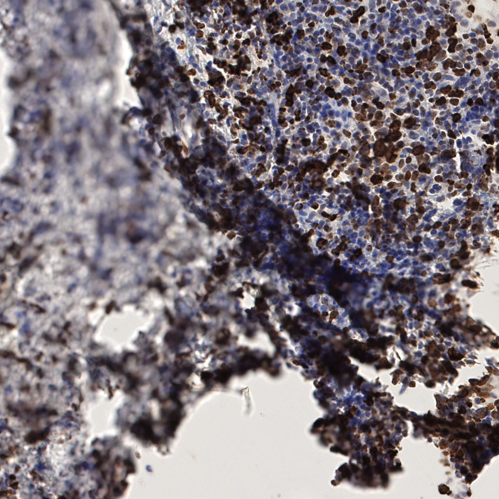 slice_58_12_x51968_y10752.png