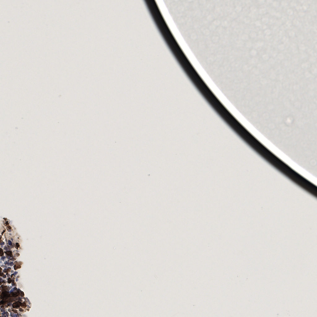 slice_59_10_x52864_y8960.png