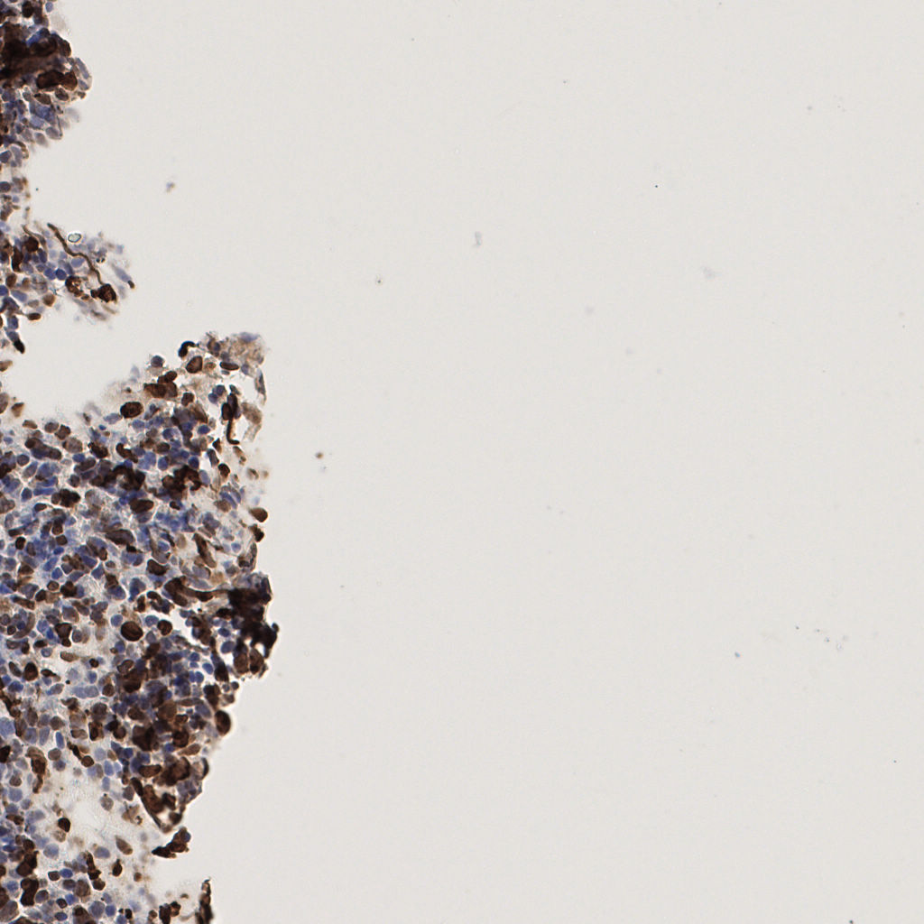 slice_59_11_x52864_y9856.png