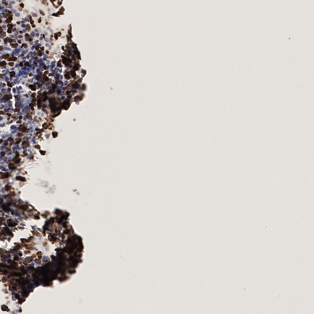 slice_59_12_x52864_y10752.png